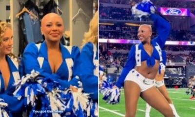 Líder de torcida do Dallas Cowboys dança sem peruca em jogo e fala sobre alopecia