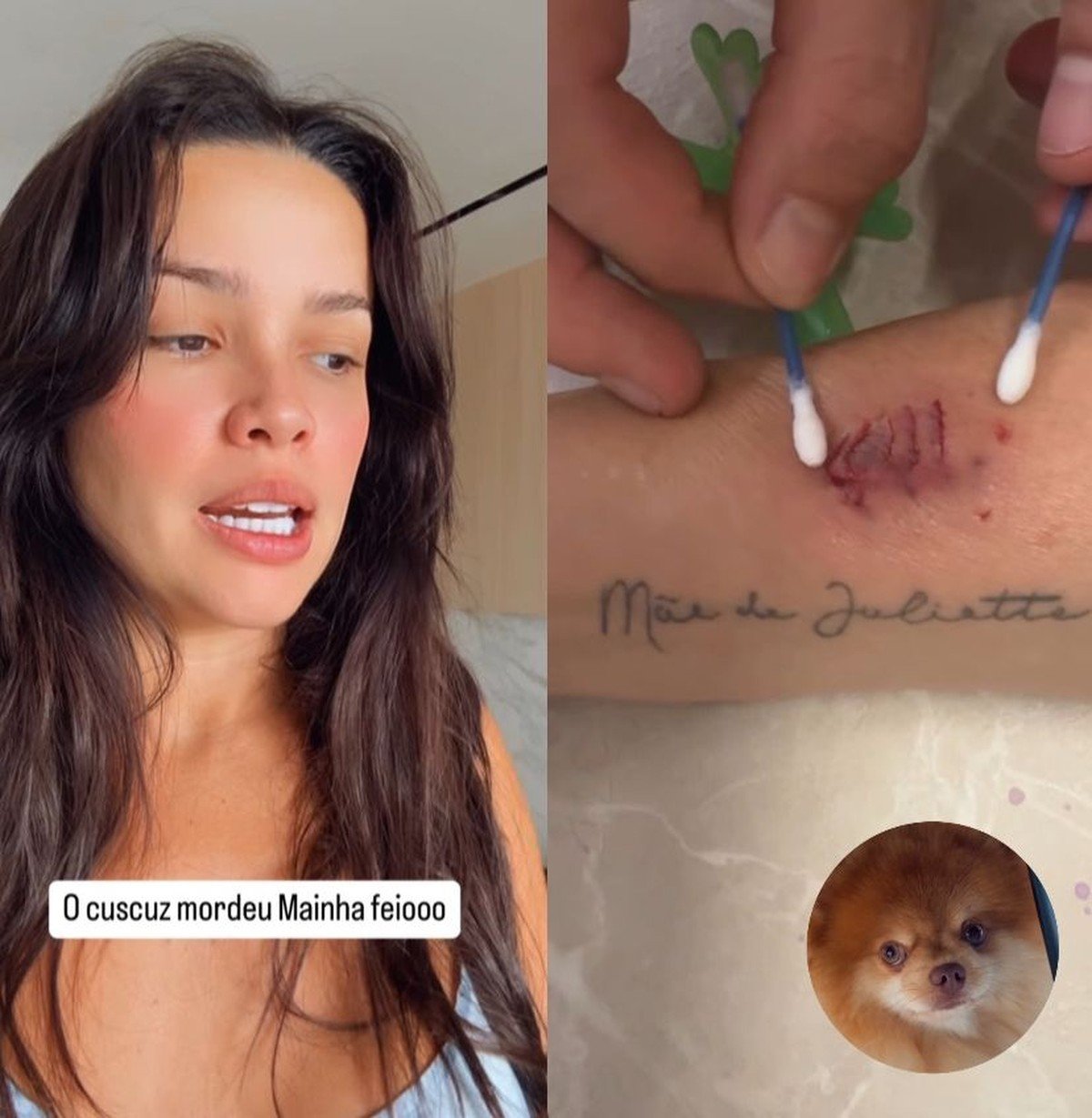 Juliette compartilha imprevisto com seus fãs após mãe ser mordida por pet | Celebridades