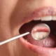 Tártaro Dental: Desvendando Por Que Algumas Pessoas São Mais Propensas ao Acúmulo e Como Prevenir
